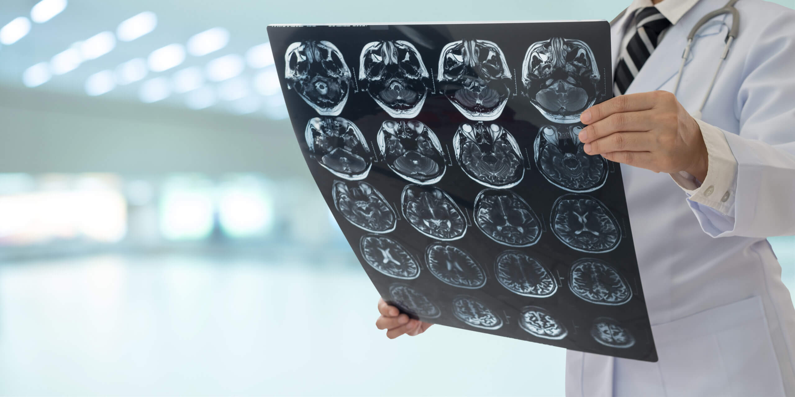 doctor examining brain scan