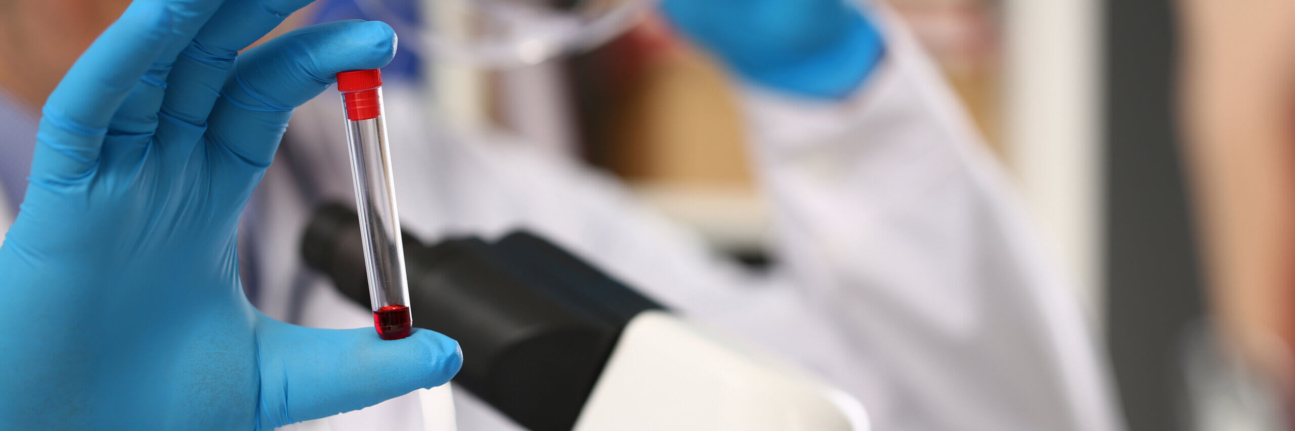 blood vial being held by doctor